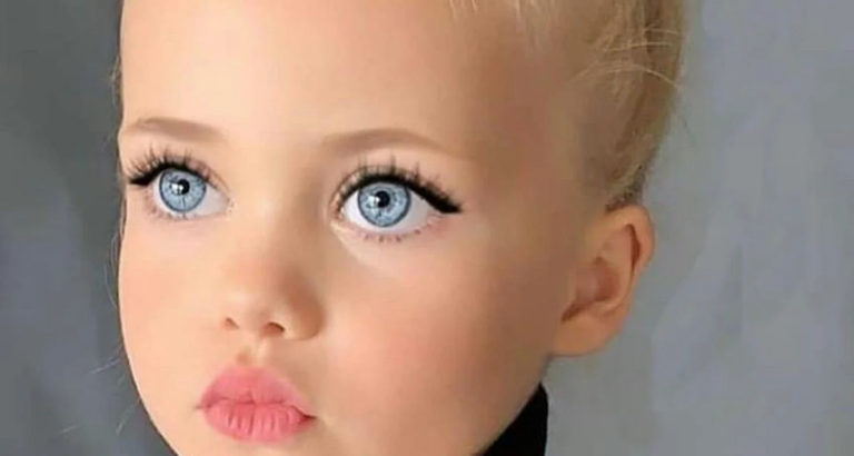 At the age of 4, she was dubbed ‘the most beautiful girl in the world’ – This is what she looks at 20 years old