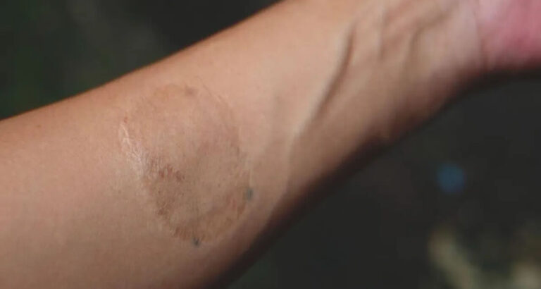 Boss Sees Scar on His Cleaning Lady and Tearfully Throws Himself into Her Arms – Story of the Day